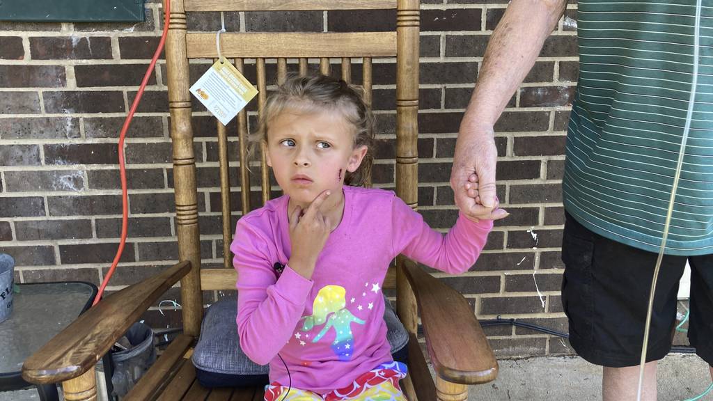 Kinsley White, 6, shows reporters a wound left on her face, April 20, 2023, in Gastonia, N.C. A North Carolina man shot and wounded a 6-year-old girl and her parents after children went to retrieve a basketball that had rolled into his yard, according to neighbors and the girl's family.