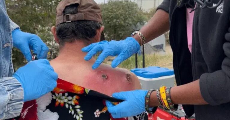 Street Medicine Brings Care to Unhoused Angelenos — But Housing Remains the Missing Prescription – Observer Group Newspapers of Southern California, inc.